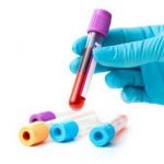 Nguyên nhân và cơ chế của giảm glucose máu và tăng glucose máu