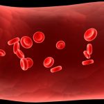 Sinh lý bệnh thiếu máu và nguyên nhân