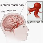 RỐI LOẠN VI TUẦN HOÀN CỤC BỘ VÀ TOÀN THÂN