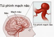 RỐI LOẠN VI TUẦN HOÀN CỤC BỘ VÀ TOÀN THÂN
