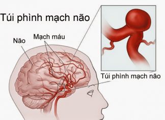 RỐI LOẠN VI TUẦN HOÀN CỤC BỘ VÀ TOÀN THÂN