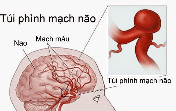 RỐI LOẠN VI TUẦN HOÀN CỤC BỘ VÀ TOÀN THÂN