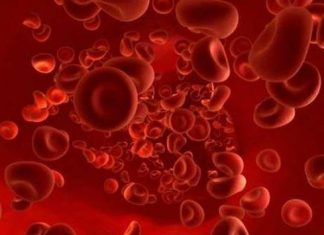 RỐI LOẠN VI TUẦN HOÀN TOÀN THÂN