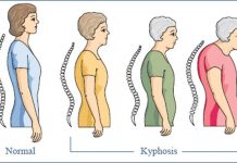 Các loại thực phẩm dễ gây loãng xương