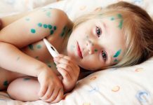 NHỮNG ĐIỀU CẦN BIẾT VỀ BỆNH THỦY ĐẬU