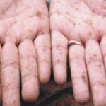 Tác hại của chì và đồng