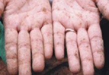 nguồn phát sinh kim loại nặng trong công nghiệp và sự ảnh hưởng đến con người