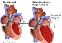 ĐỪNG COI THƯỜNG VẾT THƯƠNG DO MÈO CẮN PHẢI