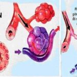 TRIỆU CHỨNG BỆNH PHỔI TẮC NGHẼN MẠN TÍNH.