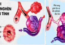 TRIỆU CHỨNG BỆNH PHỔI TẮC NGHẼN MẠN TÍNH.