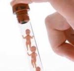 Bệnh basedow về phương diện chuẩn đoán phân biệt