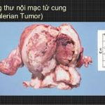 Giải phẫu và các động tác bình thường của khớp vai trên cơ thể