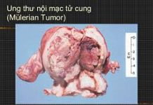 Giải phẫu và các động tác bình thường của khớp vai trên cơ thể