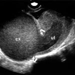Giải phẫu và cách phối hợp động tác của xương quay cơ thể