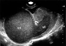 Giải phẫu và cách phối hợp động tác của xương quay cơ thể