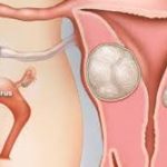 Định nghĩa và nguyên nhân gây ra tình trạng ho kéo dài cùng giải pháp phòng ngừa