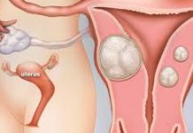 Định nghĩa và nguyên nhân gây ra tình trạng ho kéo dài cùng giải pháp phòng ngừa