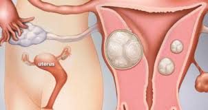 Định nghĩa và nguyên nhân gây ra tình trạng ho kéo dài cùng giải pháp phòng ngừa