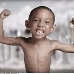 Chế độ ăn cho trẻ suy dinh dưỡng suy dinh dưỡng