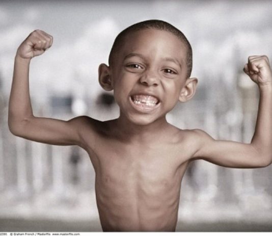 Chế độ ăn cho trẻ suy dinh dưỡng suy dinh dưỡng