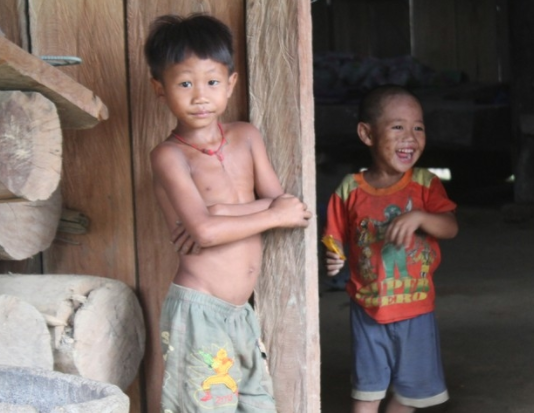 Đánh giá tình trạng dinh dưỡng của trẻ em