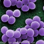 Ngộ độc thực phẩm do tụ cầu khuẩn tụ cầu khuẩn