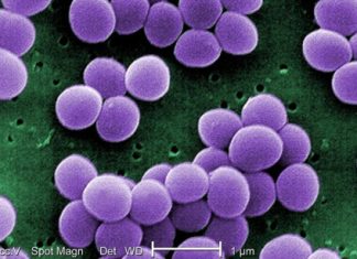 Ngộ độc thực phẩm do tụ cầu khuẩn tụ cầu khuẩn