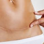 Những điều cần biết về vỡ tử cung trong chuyển dạ