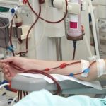 Một số phương pháp điều trị thay thế thận trong suy thận mạn