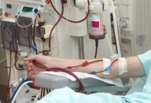 Một số phương pháp điều trị thay thế thận trong suy thận mạn