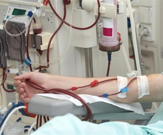 Một số phương pháp điều trị thay thế thận trong suy thận mạn