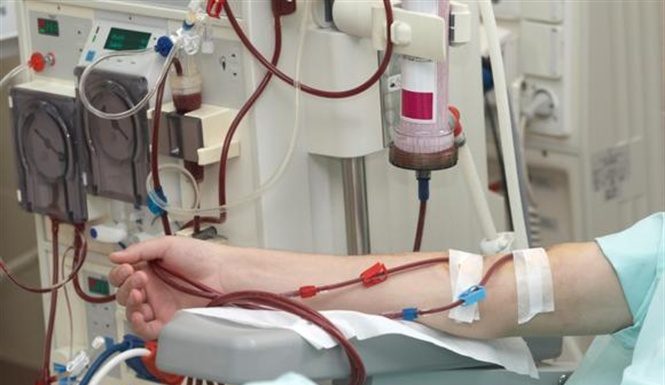 Một số phương pháp điều trị thay thế thận trong suy thận mạn