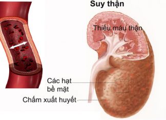 Sự thay đổi dược động học ở bệnh nhân suy giảm chức năng thận