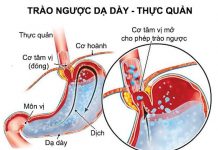 Thăm dò chức năng thực quản, dạ dày