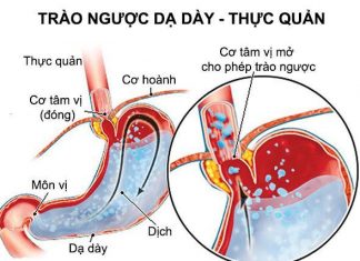 Thăm dò chức năng thực quản, dạ dày