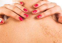 Điều trị và dự phòng bệnh da liễu