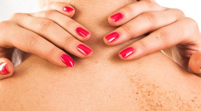 Điều trị và dự phòng bệnh da liễu