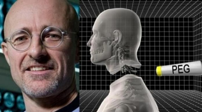 Cấy ghép cơ quan