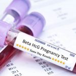 Các triệu chứng lâm sàng của thai ngoài tử cung-vấn đề chị em cần lưu ý