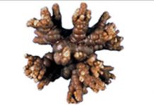 Các chẩn đoán lâm sàng và chẩn đoán phân biệt sỏi tiết niệu