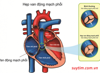 Nghiên cứu vi thể bệnh thấp tim cấp.