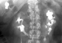 Xét nghiệm và chẩn đoán hình ảnh chẩn đoán sỏi tiết niệu