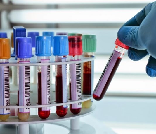 Xét nghiệm sinh hóa máu
