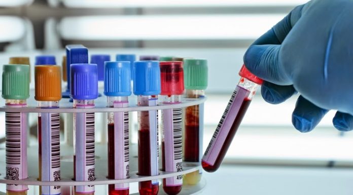 Xét nghiệm sinh hóa máu