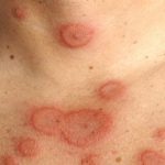 Những việc cần làm khi nghi ngờ phản ứng bất lợi của thuốc