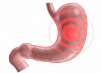 Viêm dạ dày: Phân loại và sinh lý bệnh