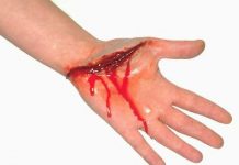 Một số điều cần biết về nguyên nhân gây suy thận cấp