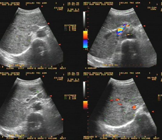 Thăm dò hình thái đường tiêu hóa bằng siêu âm qua thành bụng