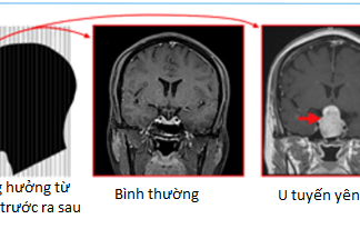 Khái niệm và đặc điểm của u