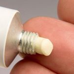 Một số triệu chứng và điều trị bệnh sùi mào gà sinh dục